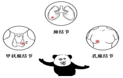 體檢查出結(jié)節(jié)，真的會(huì)癌變嗎？別慌，這樣處理就對(duì)了！