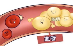 收好這份“血脂達(dá)標(biāo)數(shù)據(jù)”，盡量不給血管添堵