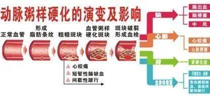 關(guān)于降脂藥的那些事兒，一文全看懂！